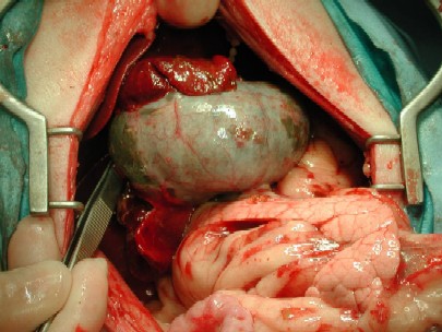 gall_bladder4.jpg